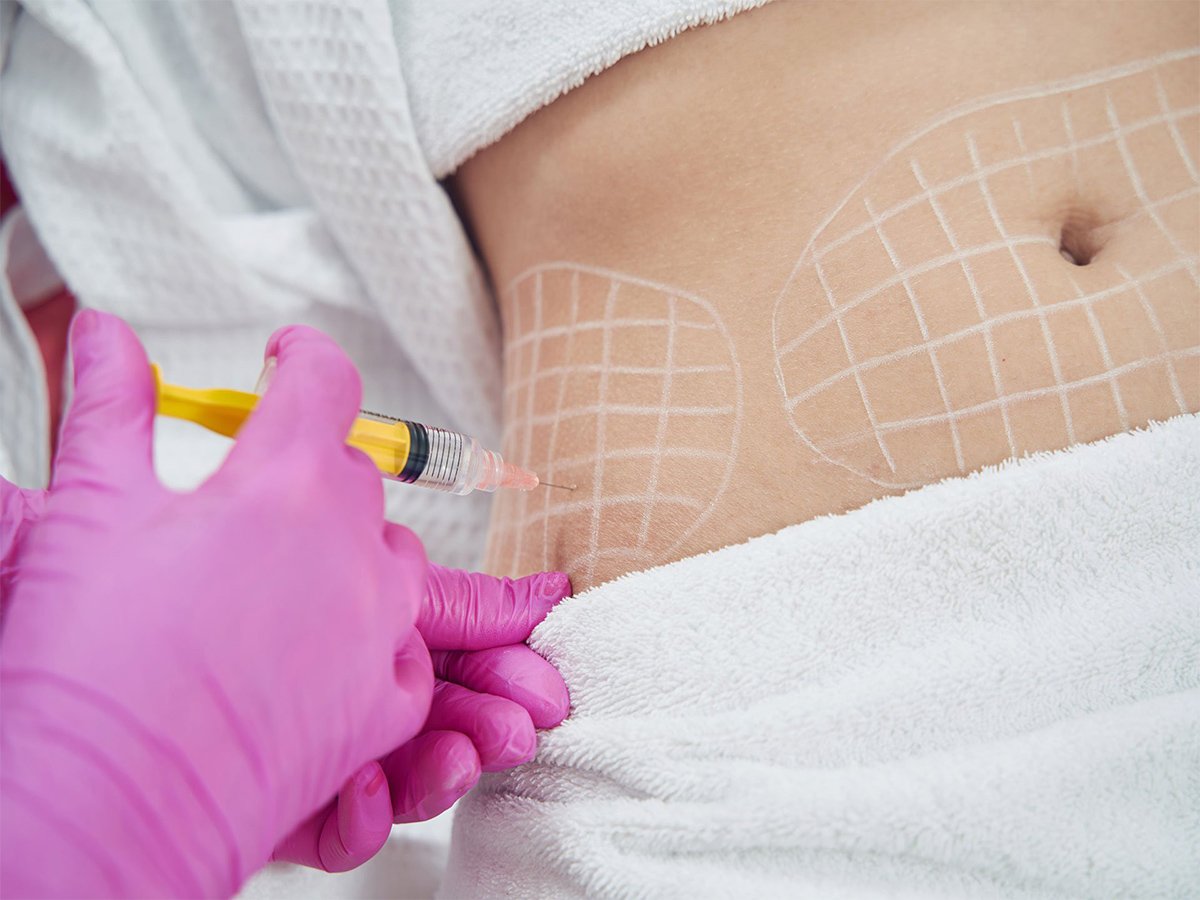 Fat Dissolving Injection